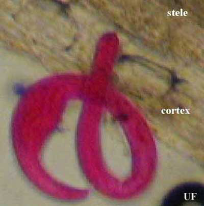 Young female of reniform nematode