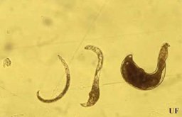 Life stages of reniform nematode, Rotylenchulus reniformis Linford & Oliveira. Ranging from left to right is egg, juvenile, young female with swollen body, and mature female in kidney shape.